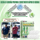Moringa · Berberina NAD Adesivo Avançado 10 em 1 com Nano Microagulhas (Somente HOJE!)🔥